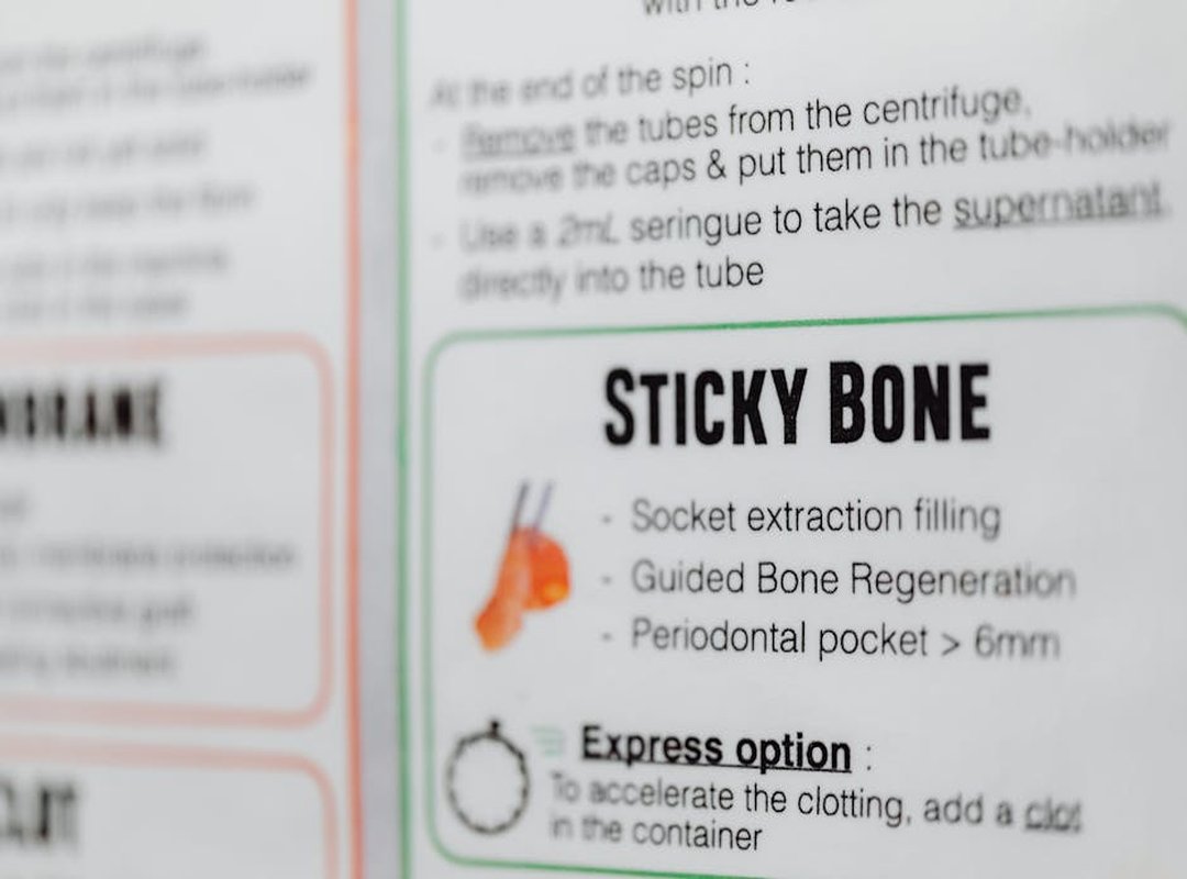 Set up Guide Tportstick